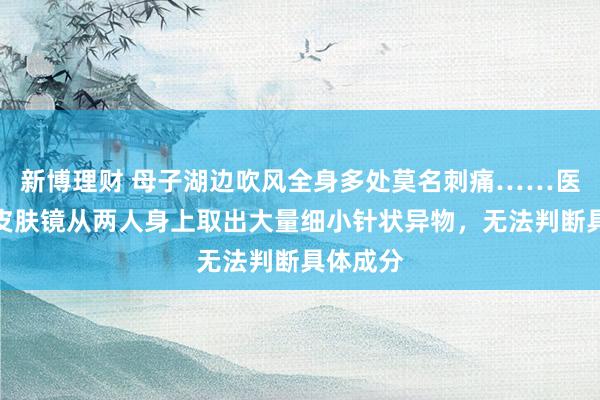 新博理财 母子湖边吹风全身多处莫名刺痛……医生借助皮肤镜从两人身上取出大量细小针状异物，无法判断具体成分